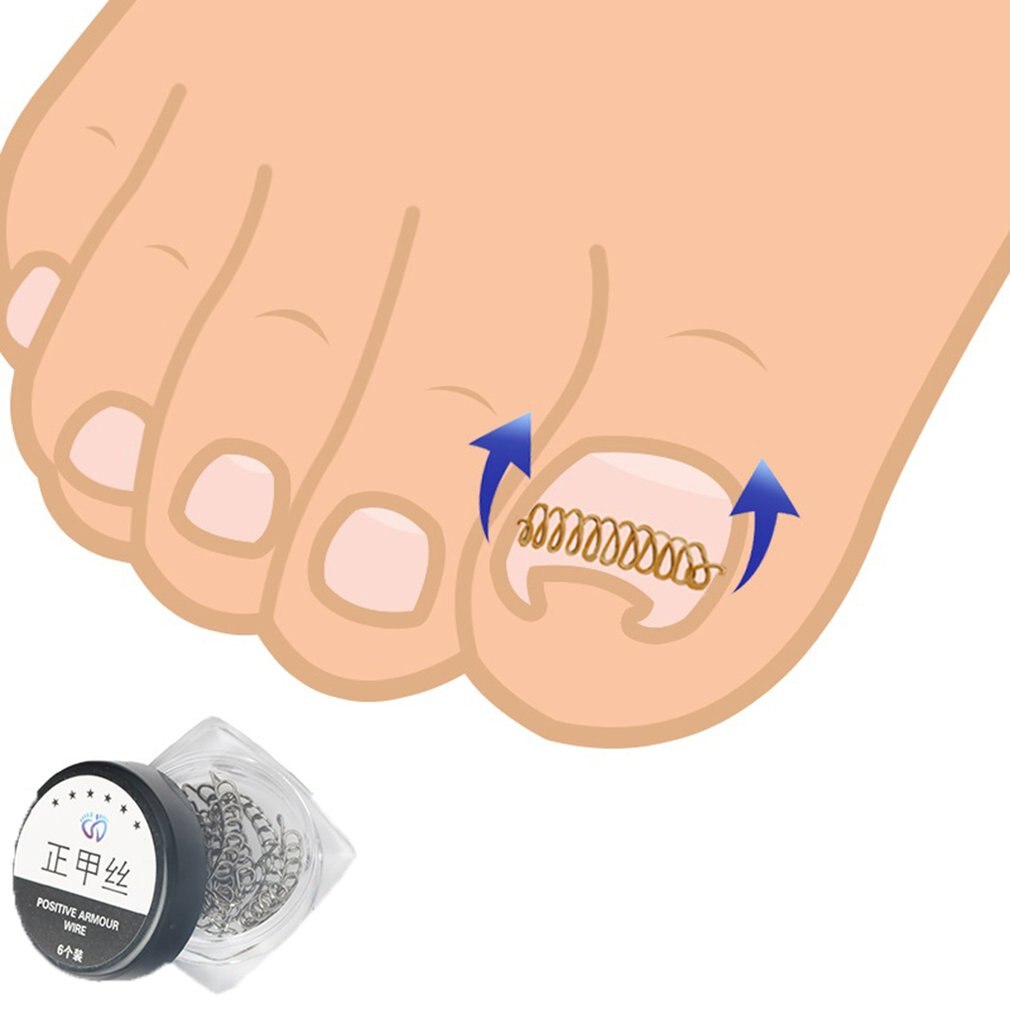 10/12/24pcs Correction File Elastic Patch Corrector Treatment Tools Toe Nail Ingrown Correction Sticker Patch - ebowsos