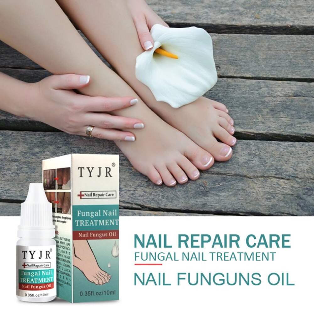 10ML Natural Formula Fungal Nail Treatment Feet Care Essence Nail Foot Whitening Toe Nail Fungus Removal Gel Liquid 2018 sell - ebowsos