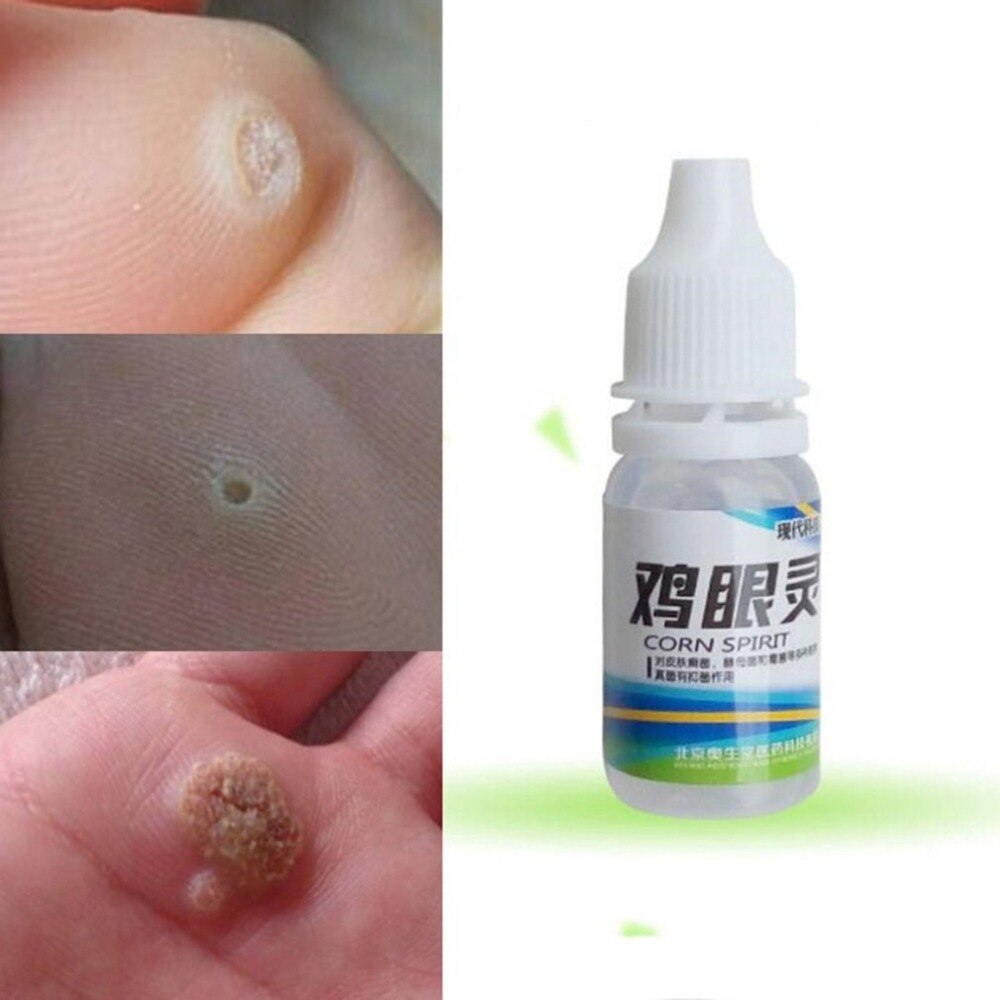 10ml Powerful Foot Corn Remover Useful Foot Callus Remover Liquid Foot Corn Foot Care Liquid - ebowsos