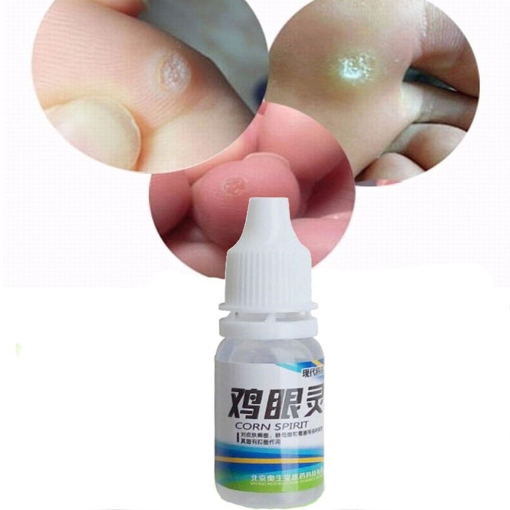 10ml Powerful Foot Corn Remover Useful Foot Callus Remover Liquid Foot Corn Foot Care Liquid - ebowsos