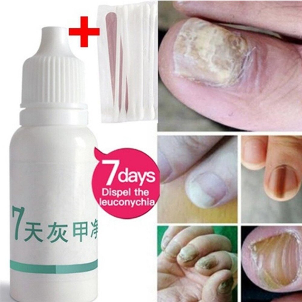 12ML Natural Herbal Nail Care Health Skin Care Nail Repair Treatment Liquid Cleanser Onychomycosis Removal Treatment Oil HOT NEW - ebowsos