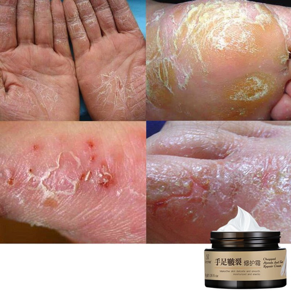 30G Moisturising Repair Cream Nourish Hand and Food Cream Women Hand and Foot Care Prevention of Skin Cracking - ebowsos