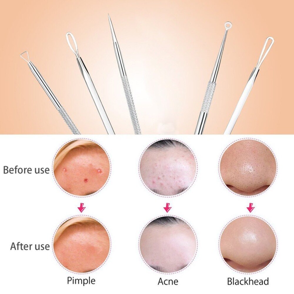7Pcs Stainless Steel Blackhead Extractor Remover Tool Pimple Blemish Extractor Facial Skincare Set Kit With Leather Storage bag - ebowsos