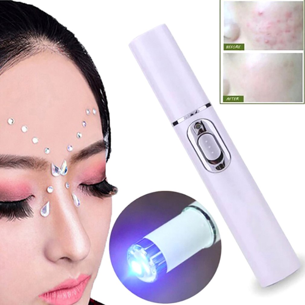 Acne Laser Pen Portable Wrinkle Removal Machine Durable Soft Scar Remover Blue Therapy Light Pen Massage Spider Vein Eraser - ebowsos