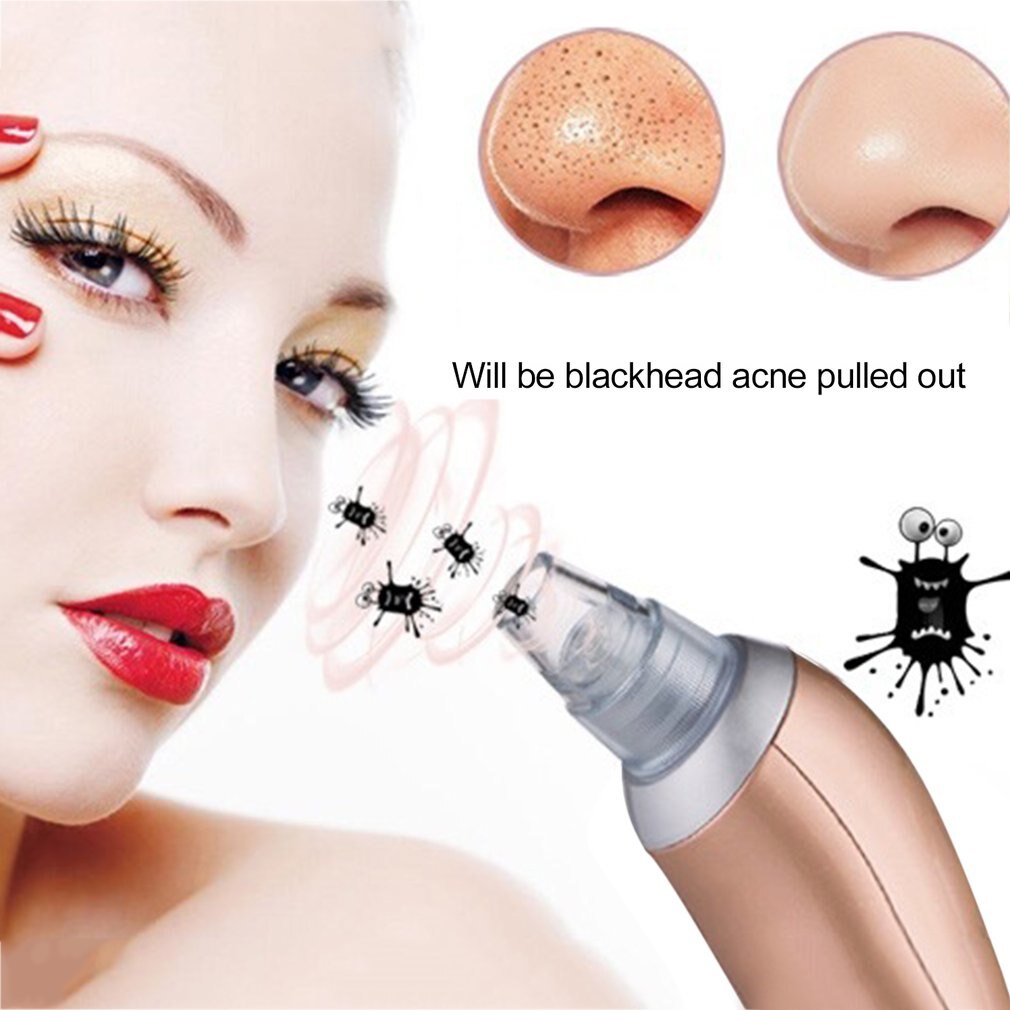 Blackhead Removal Electric Facial Vacuum Pore Cleaner Spot Acne Remover Vacuum Suction Extraction Face skin care tool - ebowsos