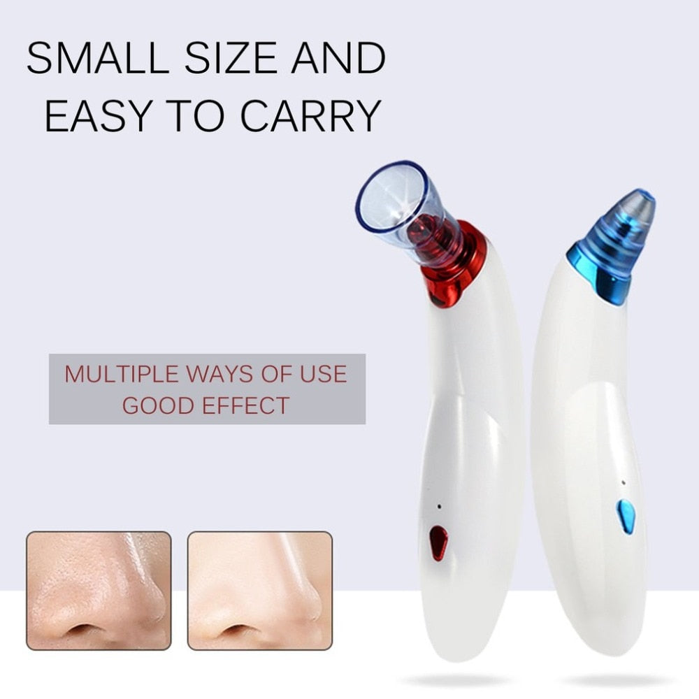 Electric Blackhead Acne Remover Vacuum Suction Machine Face Pore Cleaner Beauty Instrument Dirt Remover Face Massager - ebowsos