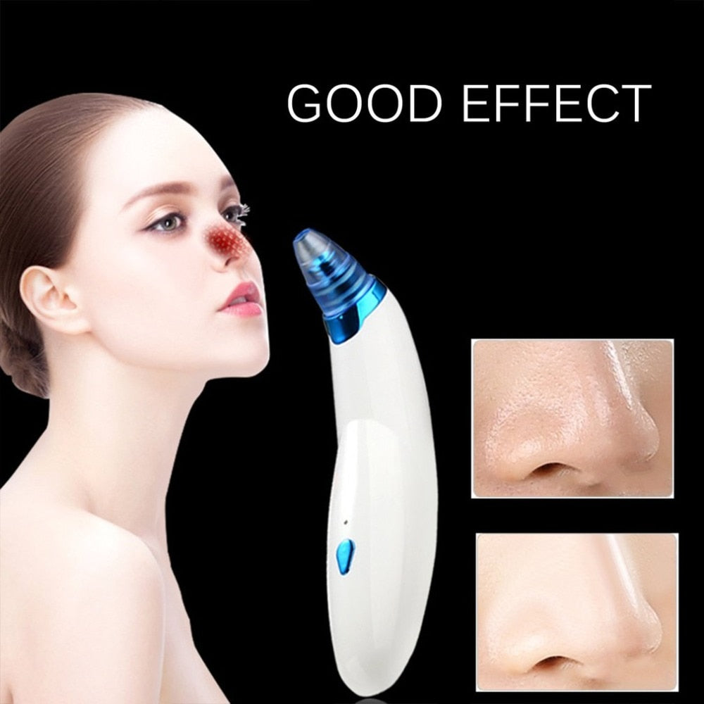 Electric Blackhead Acne Remover Vacuum Suction Machine Face Pore Cleaner Beauty Instrument Dirt Remover Face Massager - ebowsos