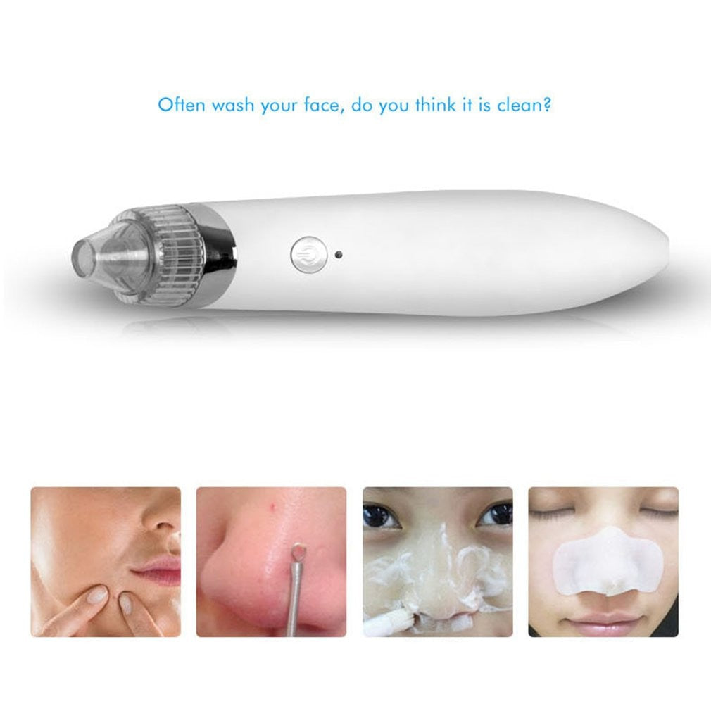 Electric Blackhead Instrument Household Beauty Facial Pore Cleaner Cleansing Instrument No battery English - ebowsos