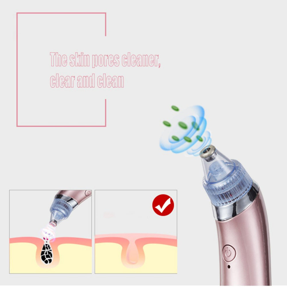 Electric Blackhead Suction Instrument Home Beauty Facial Vacuum Pore Cleaner Cleansing Instrument Suction Dispel Acne Artifact - ebowsos