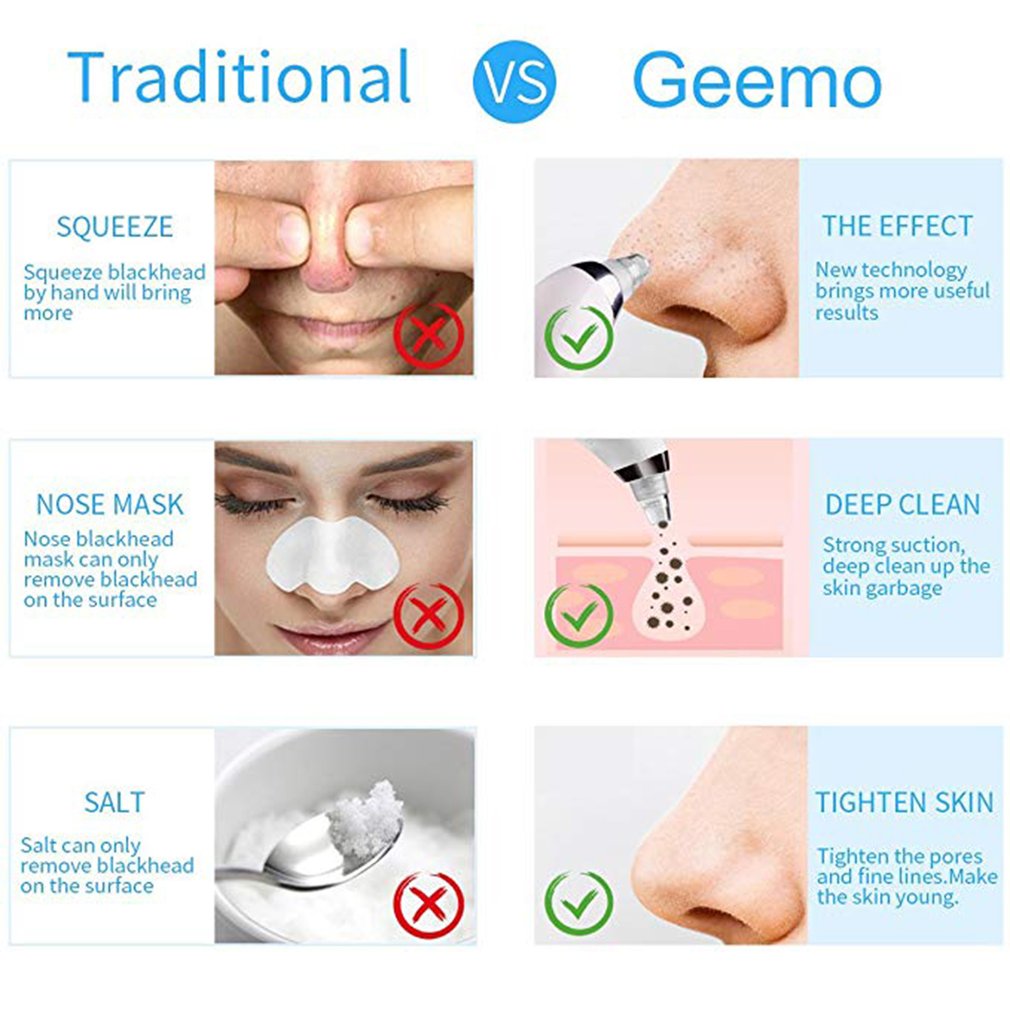 Electronic Blackhead Suction Remover Blackhead Cleaner Facial Pore Cleanser Dead Skin Acne Removal Microdermabrasion Device - ebowsos