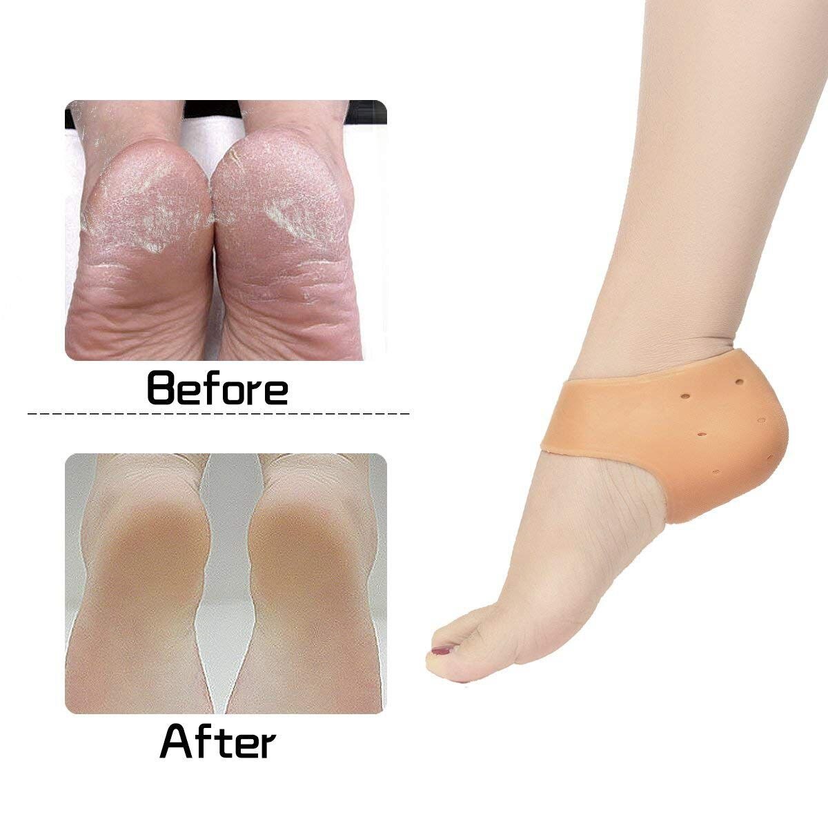 5Pairs Heel Sleeves, Breathable Silicone Heel Socks Protectors to Repair Dry Cracked Heel and Reduce Pains of Plantar Fas - ebowsos