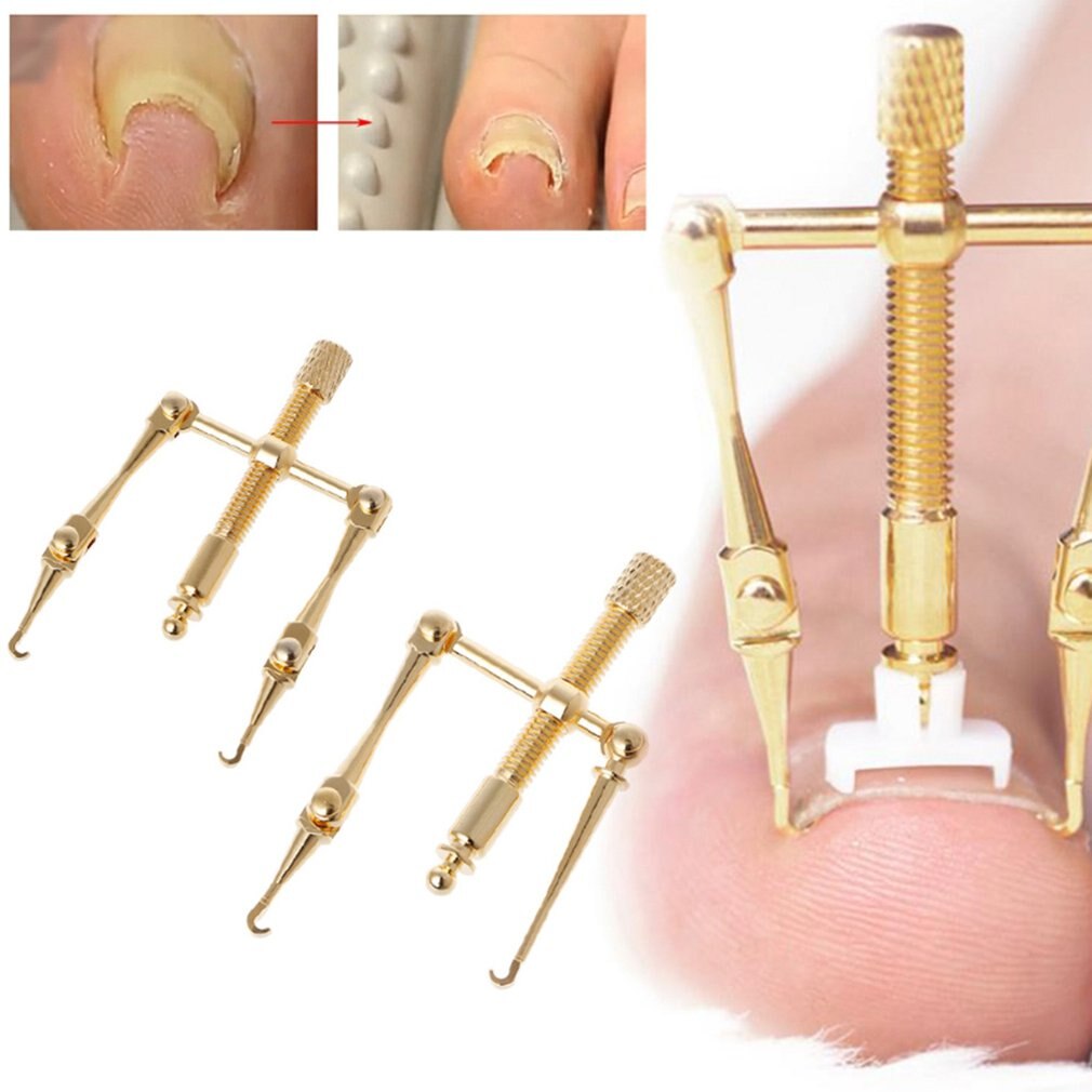 Nail Corrector Ingrown Nail Foot Correction Tool For Fixer Recover Restore Toe Paranichia Nail Brace Foot Care - ebowsos