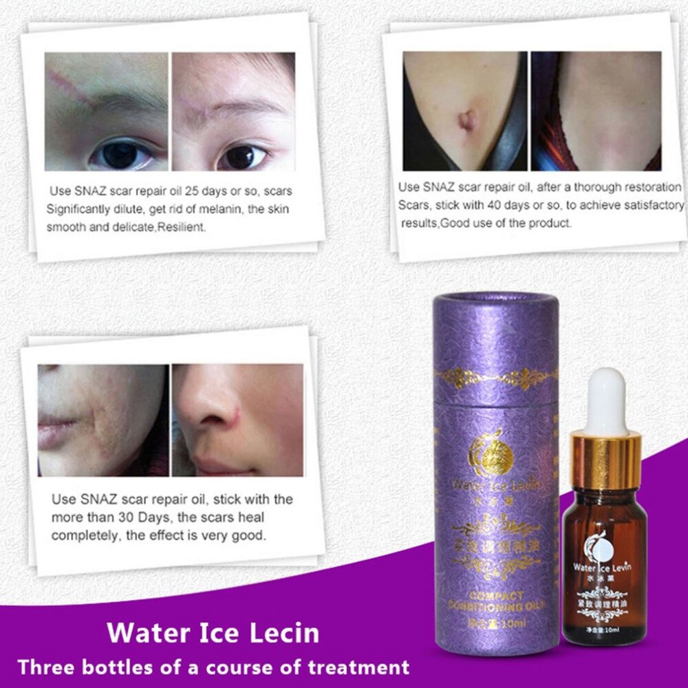 Natural Lavender Essential Oil Pure Moisturizer Shrink Pores Skin Care Acne Treatment Scar Repair Removal Burn Scarring Skin - ebowsos