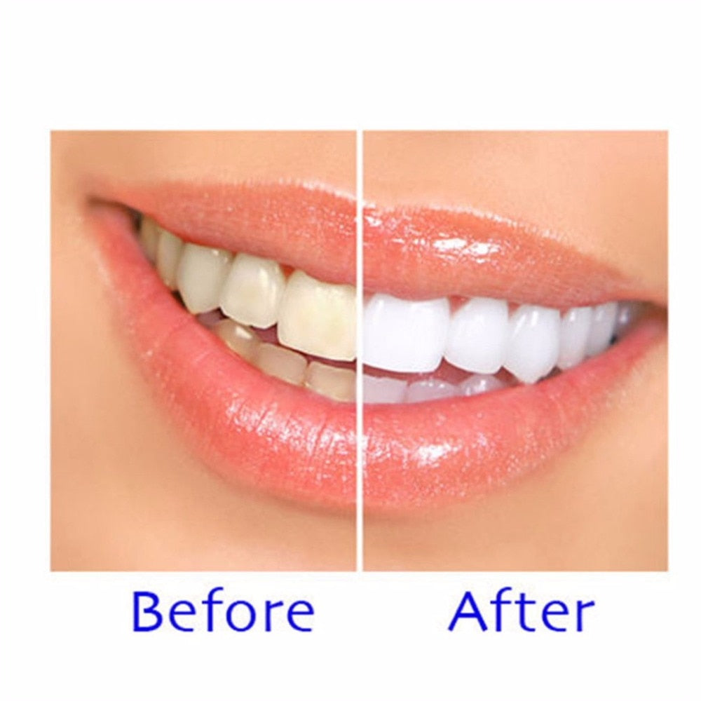 Portable Dental Equipment Teeth Whitening Dental Bleaching System Oral Gel Kit Tooth Whitener Easy to Use for Travel - ebowsos