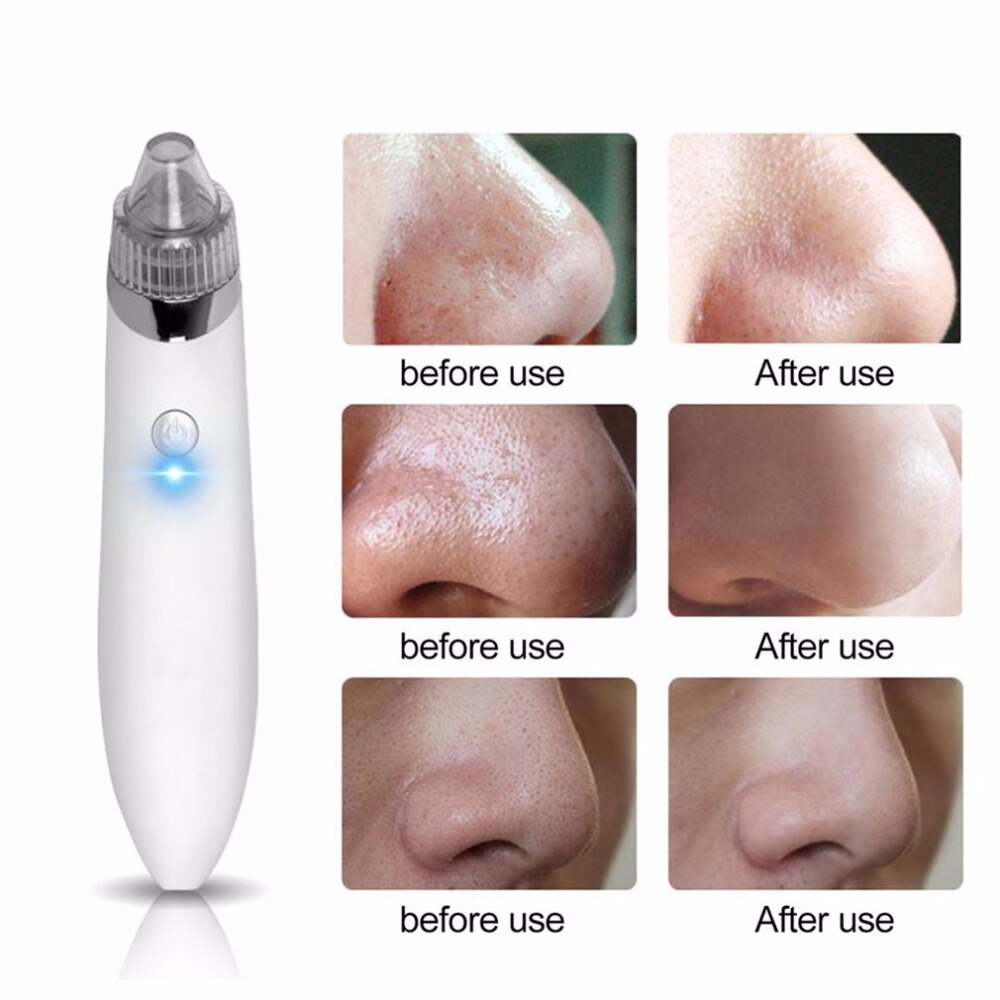 Portable Electric Blackhead Remover Facial Vacuum Pore Cleanser Face Skin Care Tool Spot Cleaner Instrument EU Plug - ebowsos