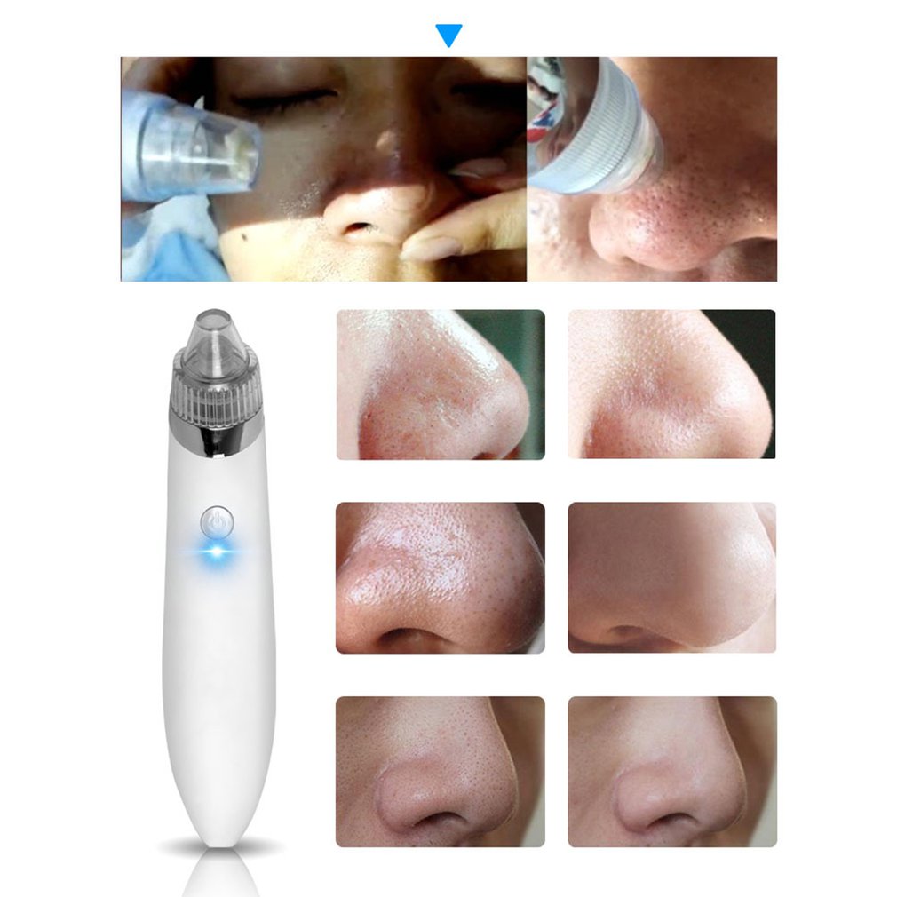 Portable USB  Mini Electric Blackhead Instrument Household Beauty Facial Pore Cleaner Rechargeable Cleansing Instrument - ebowsos