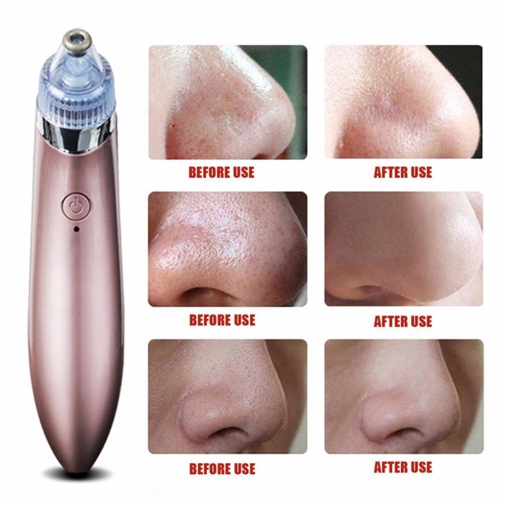 Pro Ultrasonic Vibration Electric Blackheads Suction Remover Vacuum Pore Spot Cleaner Facial Skin Care Tool Beauty Instrument - ebowsos