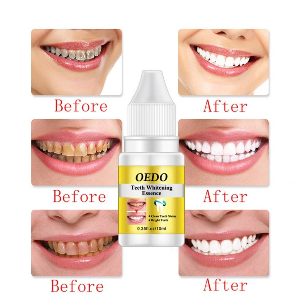 Tooth Cleaning Toothpaste Liquid For Toothbrush Cleaning Teeth Whitening Toothpaste Mouthwash For OEDO - ebowsos
