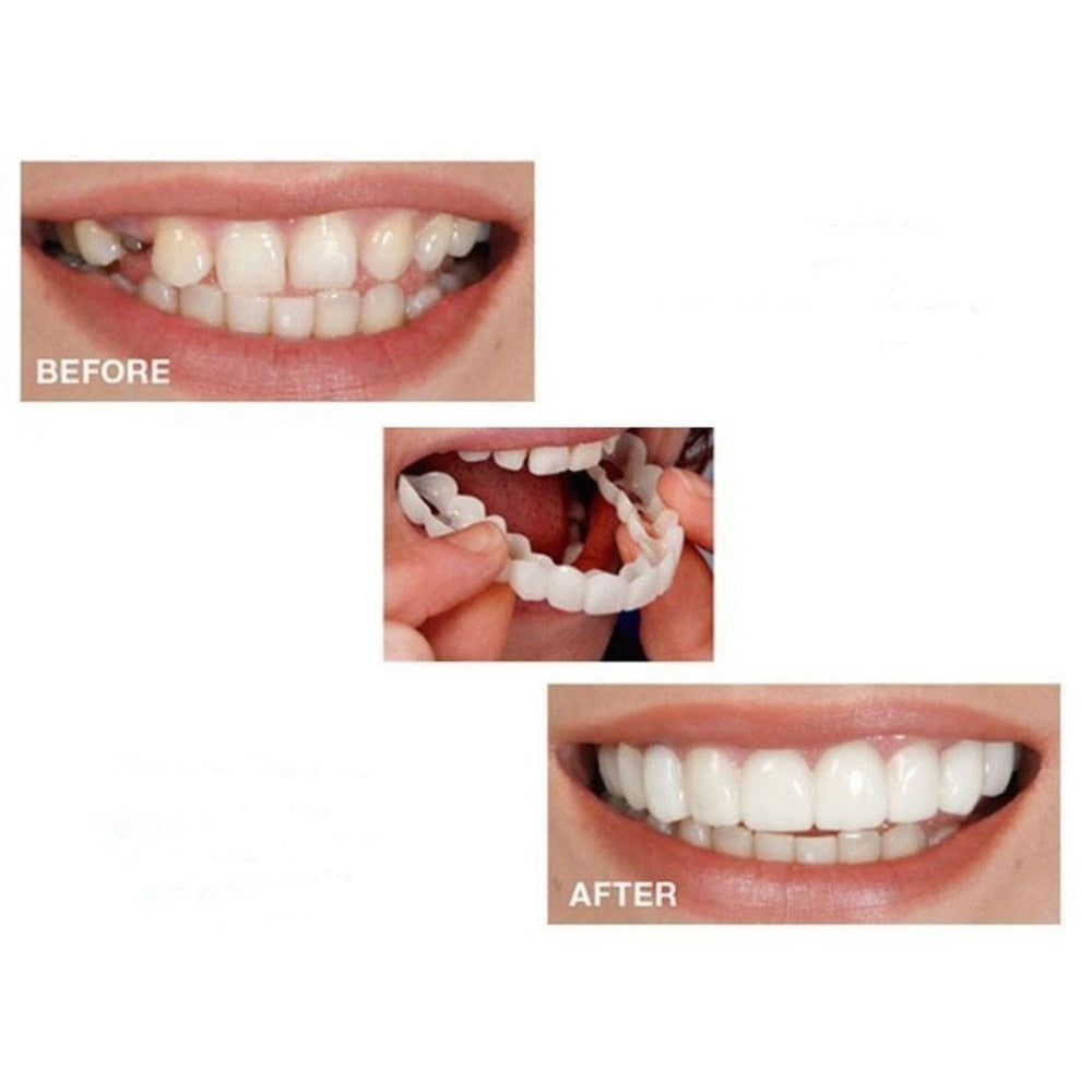 Tooth Instant Perfect Smile Flex Teeth Whitening Smile False Teeth Cover - ebowsos