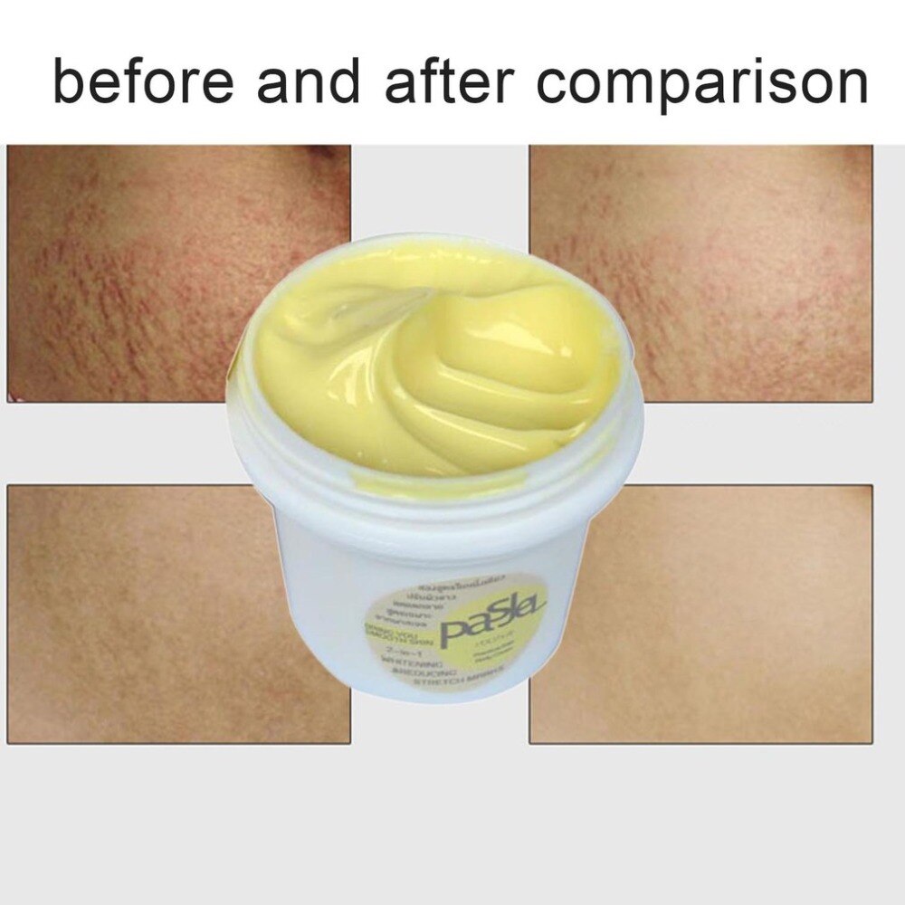 Wrinkle Cream Precious Skin Body Cream Remove Stretch Marks Treatment Postpartum Repair Whitening Pregnancy Scar Removal - ebowsos