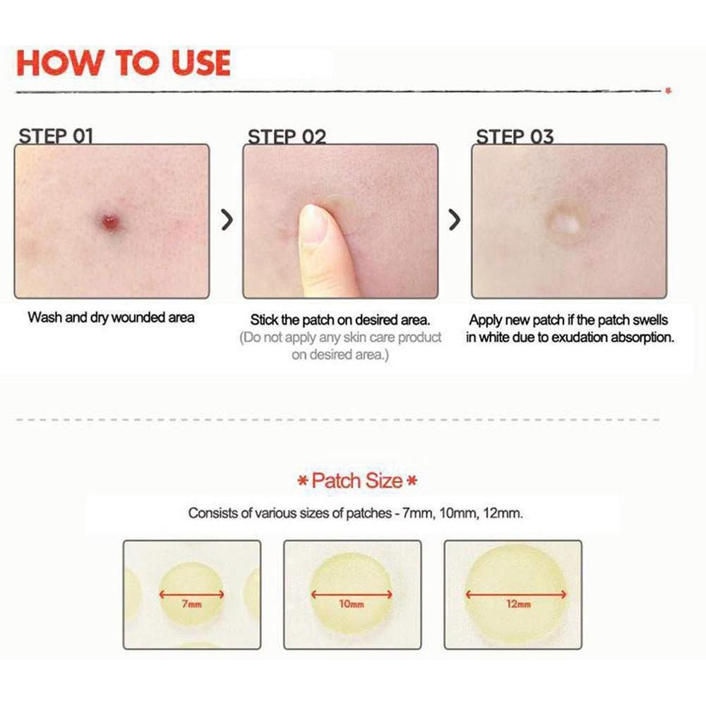 face Concealer Cosrx Pimple Master Patch 24 Patches Face Spot Scar Care Treatment Stickers - ebowsos