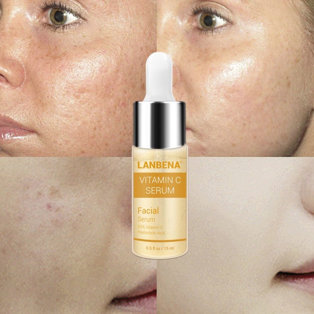lanbena Vitamin C Serum VC Removing Dark Spots Freckle Speckle Fade Ageless Skin Care Whitening Face Anti Winkles Essence Beauty - ebowsos